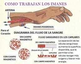 como-funcionan-los-imanes-en-magnetoterapia